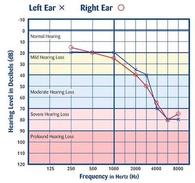 Audiometric testing